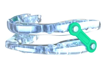 EMA oral appliance